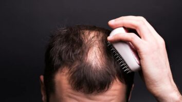 Quelles sont les causes de la perte de cheveux ?