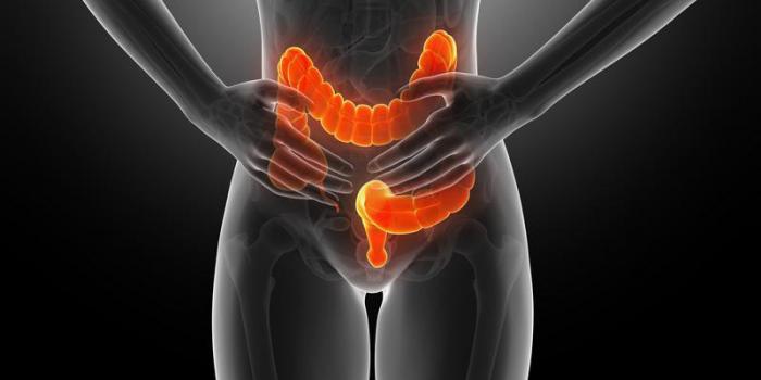 Quels sont les premiers symptômes du cancer du colon ?