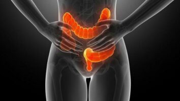 Quels sont les premiers symptômes du cancer du colon ?