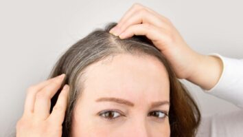 Qu'est-ce qui provoque les cheveux blancs ?