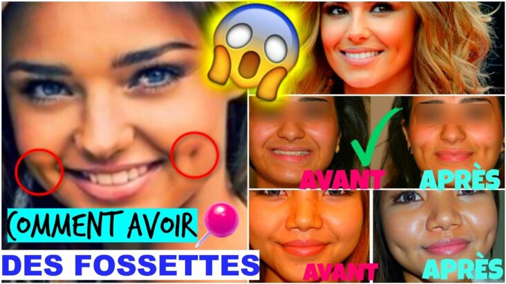 Comment avoir de belles fossettes ?