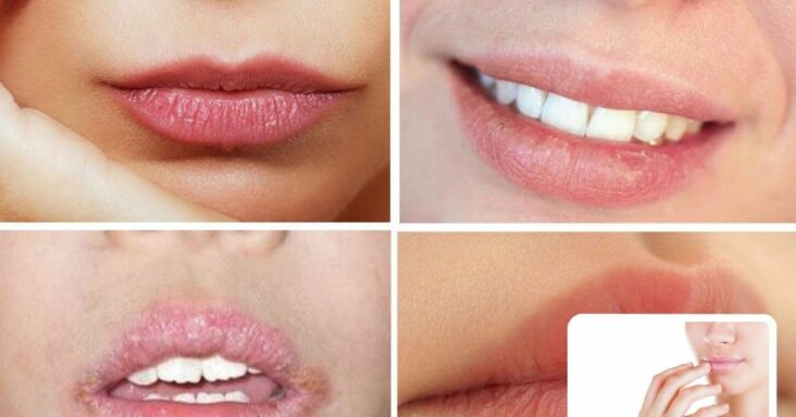 Comment blanchir les lèvres naturellement ?
