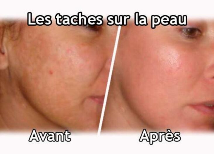 Comment faire partir les taches jaune dans les yeux ?