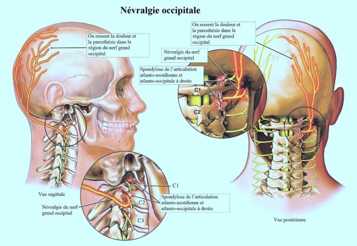 Comment savoir si les vertiges sont neurologiques ?