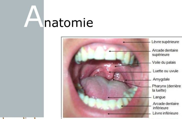 Comment savoir si on a un cancer de la bouche ?