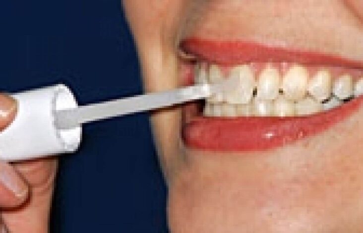 Est-ce que les dents peuvent redevenir blanche ?