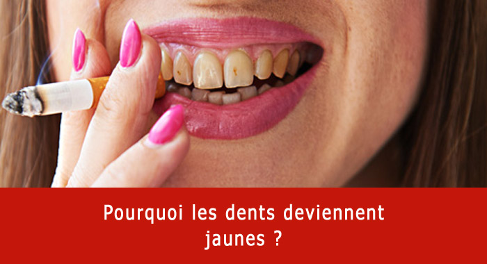 Pourquoi on a les dents jaunes ?