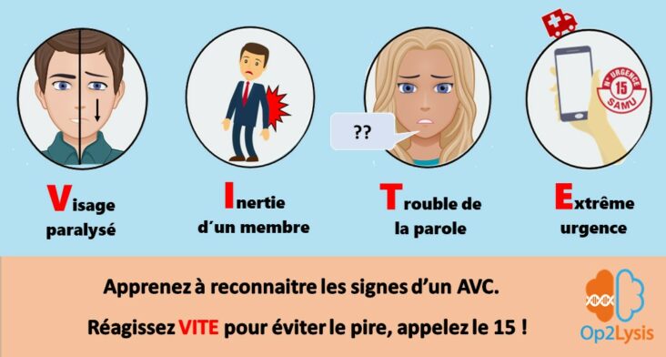 Quels sont les symptômes de l'AVC de l'œil ?